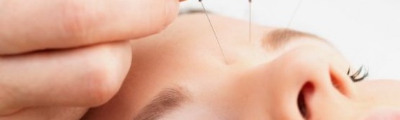 Bournemouth Acupuncture – Help for Sports Injuries • Sciatica •Shoulder problems •Arthritis •Fibromyalgia •General Stiffness •Carpal Tunnel Syndrome and more