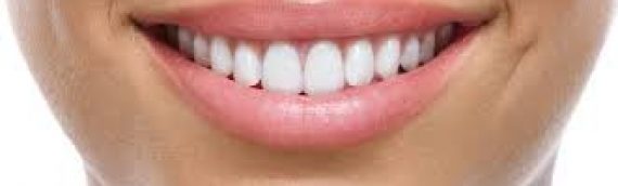 Teeth Whitening
